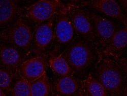 IGF-I R/IGF1R, p Tyr1165, p Tyr1166 Antibody, Novus Biologicals:Antibodies:Primary